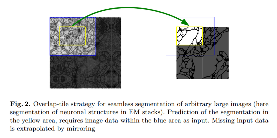 unet_overlap.png